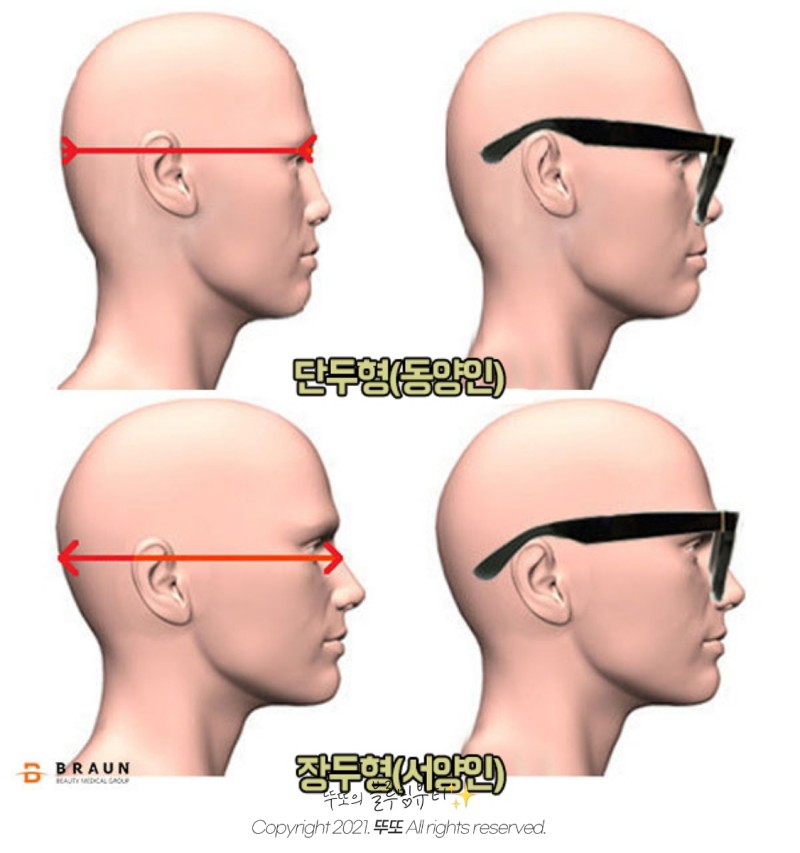 사용자첨부이미지